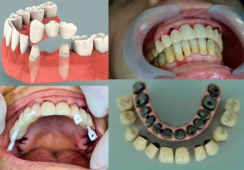 Prosthetic Dentistry